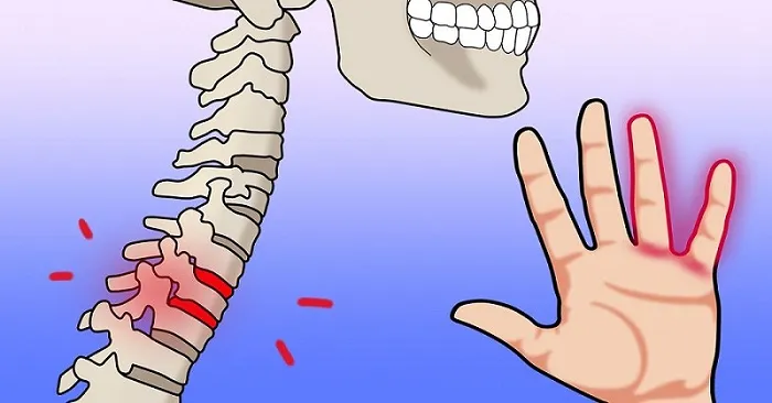 سنگینی و بی‌حسی دست؛ از یک علامت ساده تا هشداری جدی برای سلامت بدن