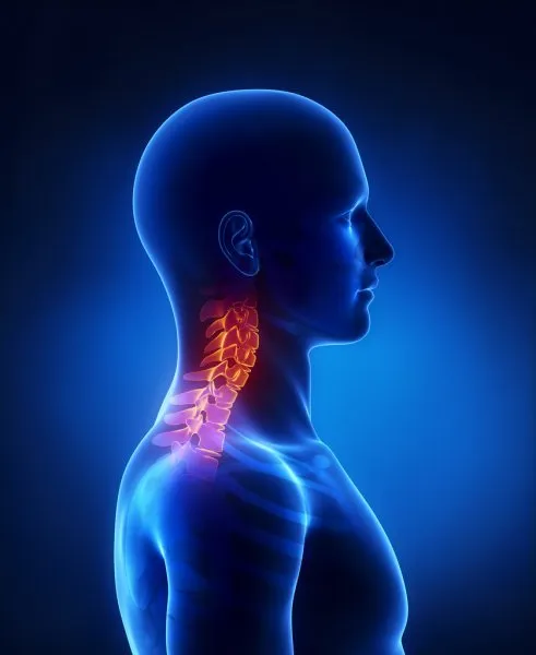 دیسک گردن: علائم، علل، تشخیص و درمان