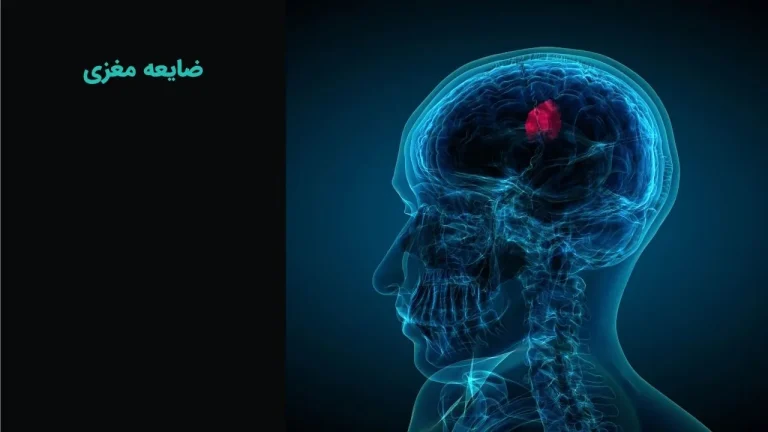 ضایعه مغزی چیست؟