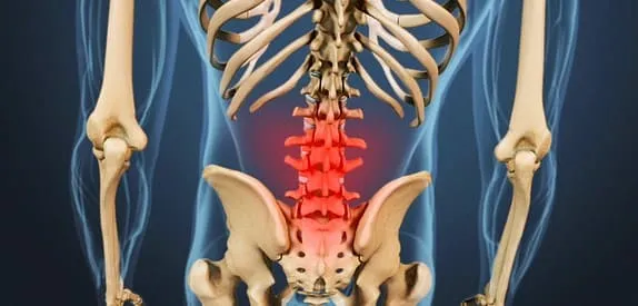 علائم و علل خشکی کمر و درمان آن