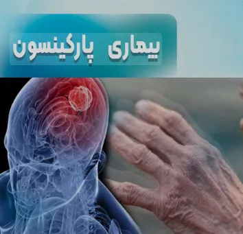 پارکینسون چیست؟ علائم، درمان و زندگی با بیماری پارکینسون