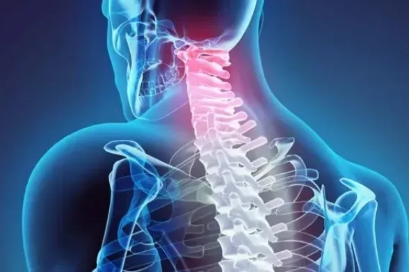 آیا دیسک گردن درمان دارد؟